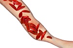 728-sicklecell