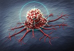 761-cancervac