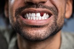 778-dentures