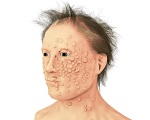 784-smallpox