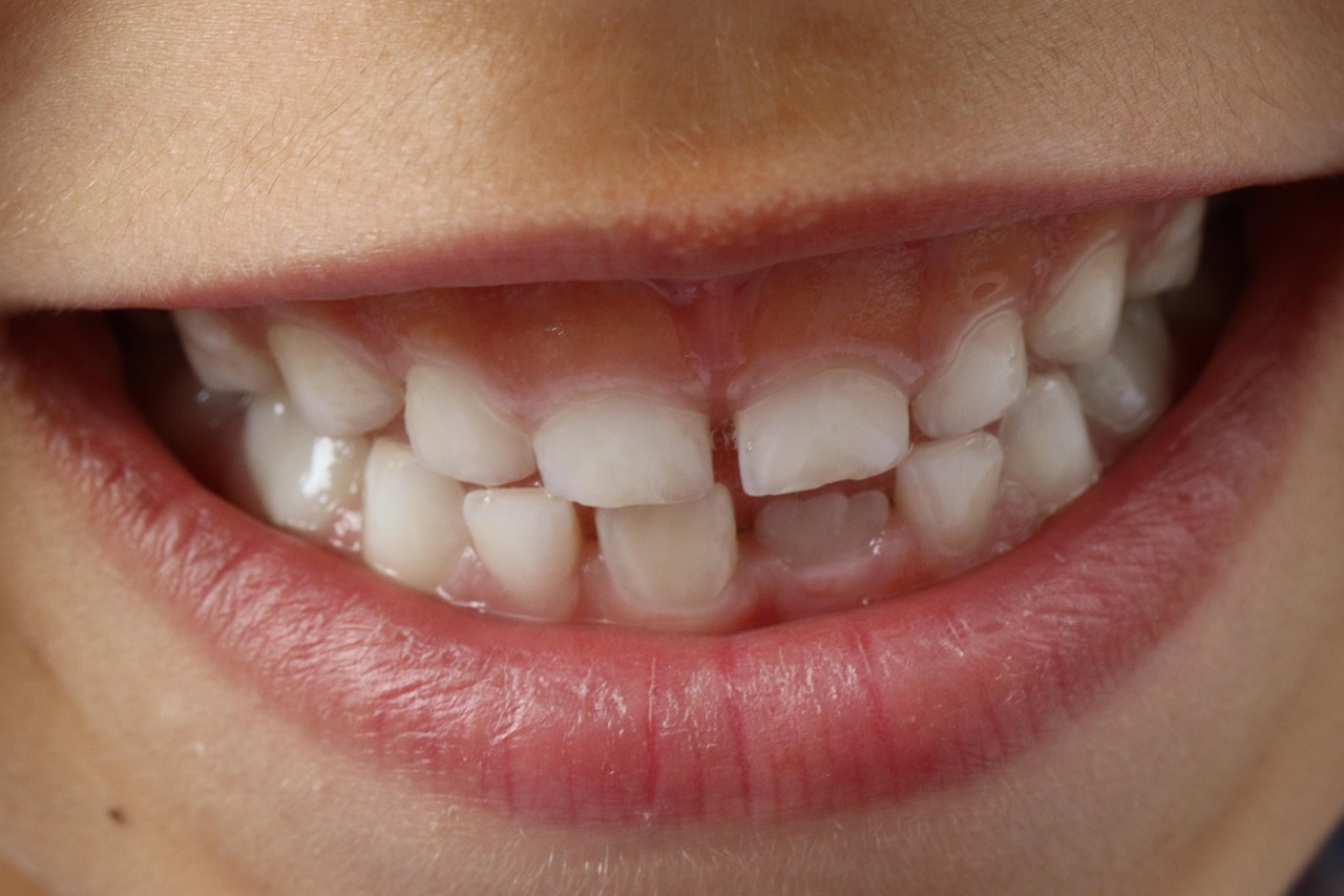person smiling showing their teeth