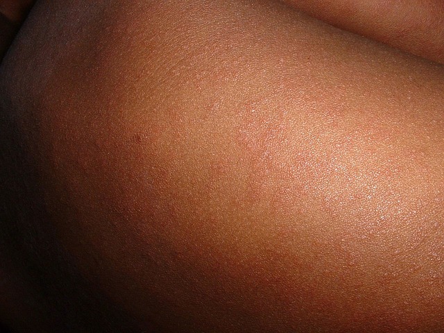 measles spots on skin