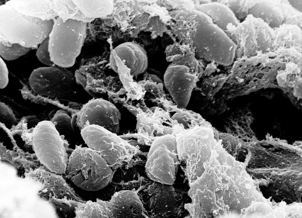 microscopic image of y pestis
